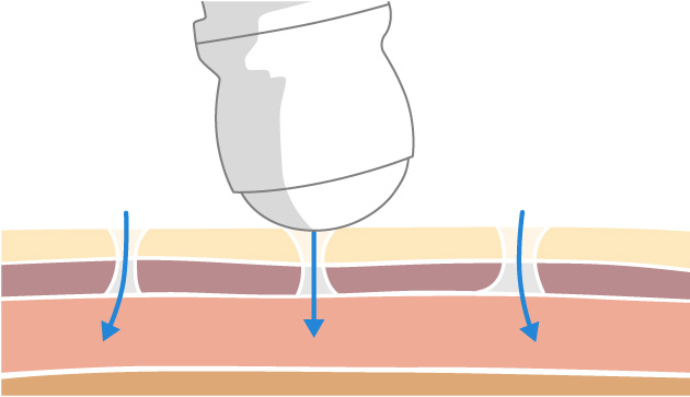 mechanism step3