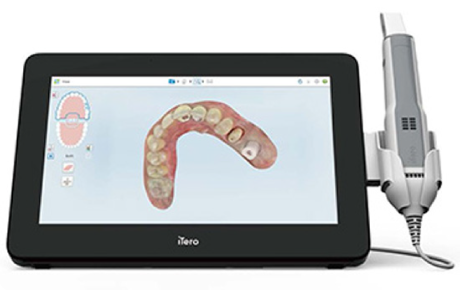口腔内3Dスキャナー iTero エレメント5Dプラス